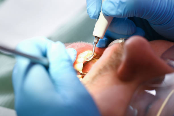 Best Pediatric Emergency Dentist in Iola, KS